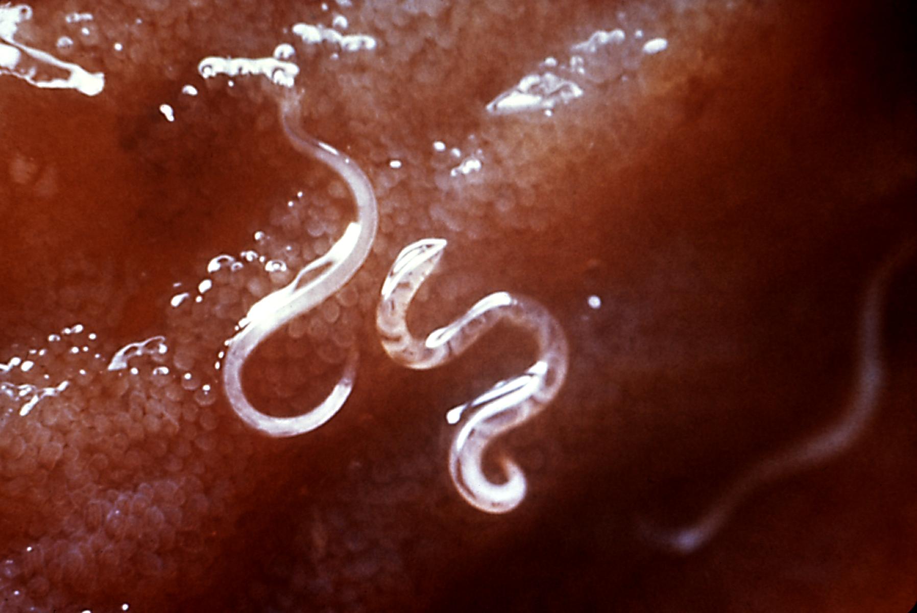 Hookworms - Endoparásitos